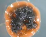 Bakterium: Actinomycet